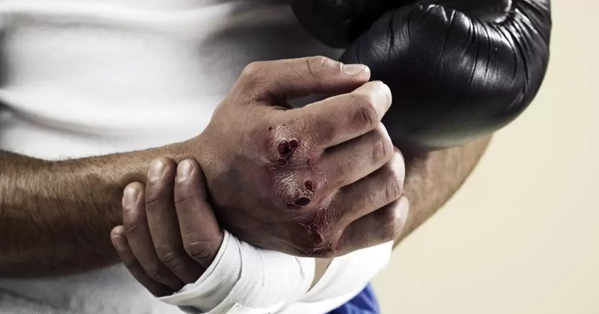 Common Hand Injuries in Boxing